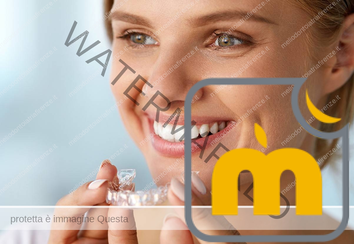 APPARECCHI DENTALI INVISIBILI